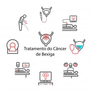 Tratamento câncer de bexiga Tratamento câncer de bexiga